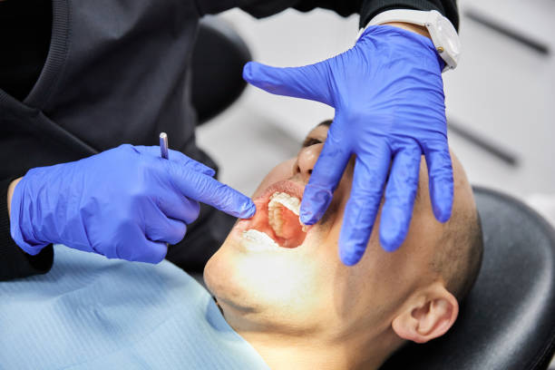 Best Emergency Gum Pain Relief  in Lahoma City, OK